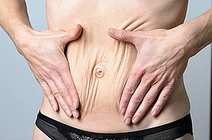 מה כוללת הערכות לניתוח?