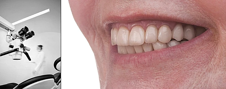 חיוך של מיליון דולר