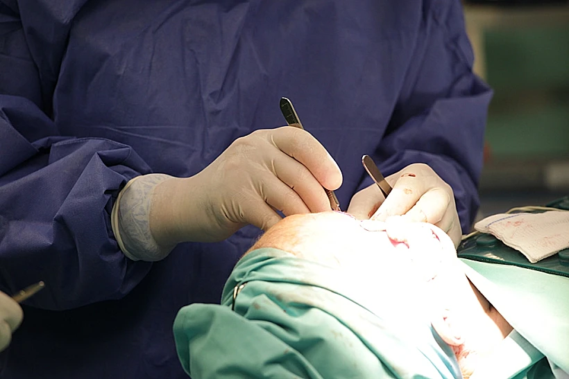 ניתוח פלסטי( צילום עצמי)