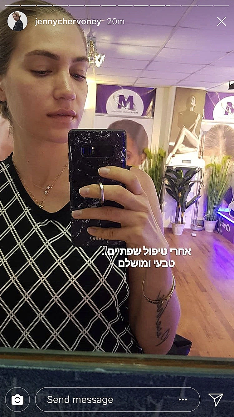 הדגשת שפתיים