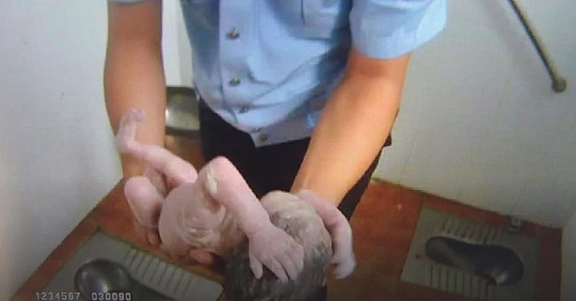 התינוקת שניצלה ממוות באסלה