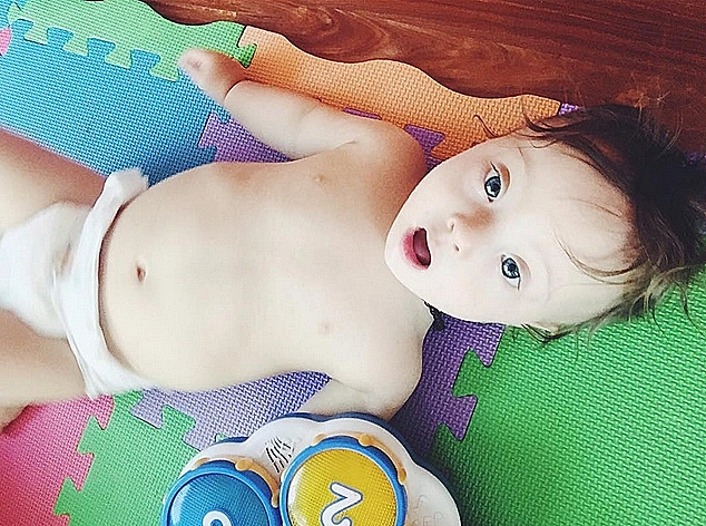 הדוגמנית שבנה סובל מתסמונת דאון