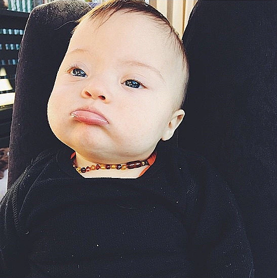 הדוגמנית שבנה סובל מתסמונת דאון