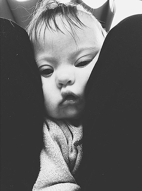 הדוגמנית שבנה סובל מתסמונת דאון