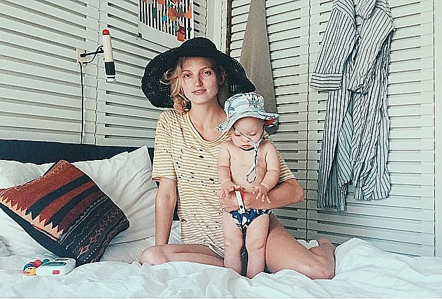 הדוגמנית שבנה סובל מתסמונת דאון