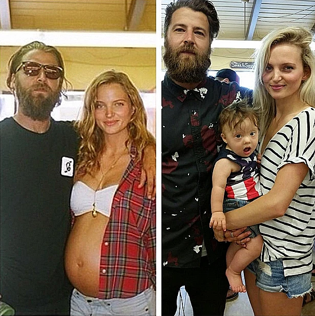 הדוגמנית שבנה סובל מתסמונת דאון