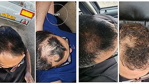 Resized Image 1709645647976 10