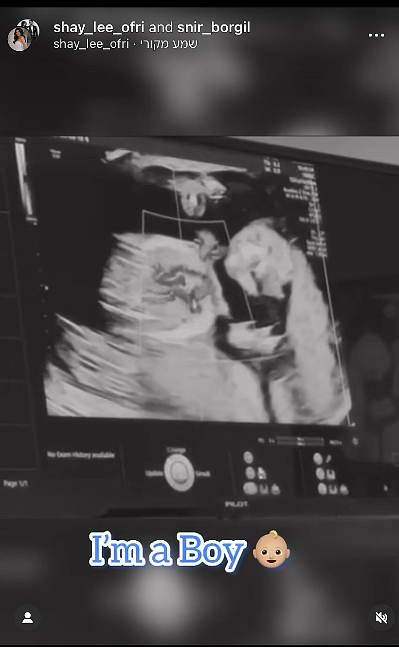 הבייבי של שי ושניר