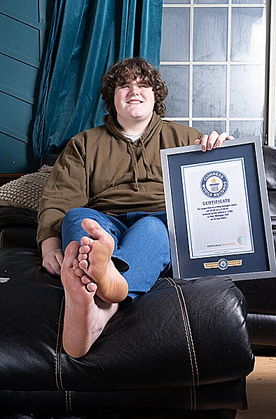 אריק קילבורן, הנער עם הידיים והרגליים הגדולות ביותר