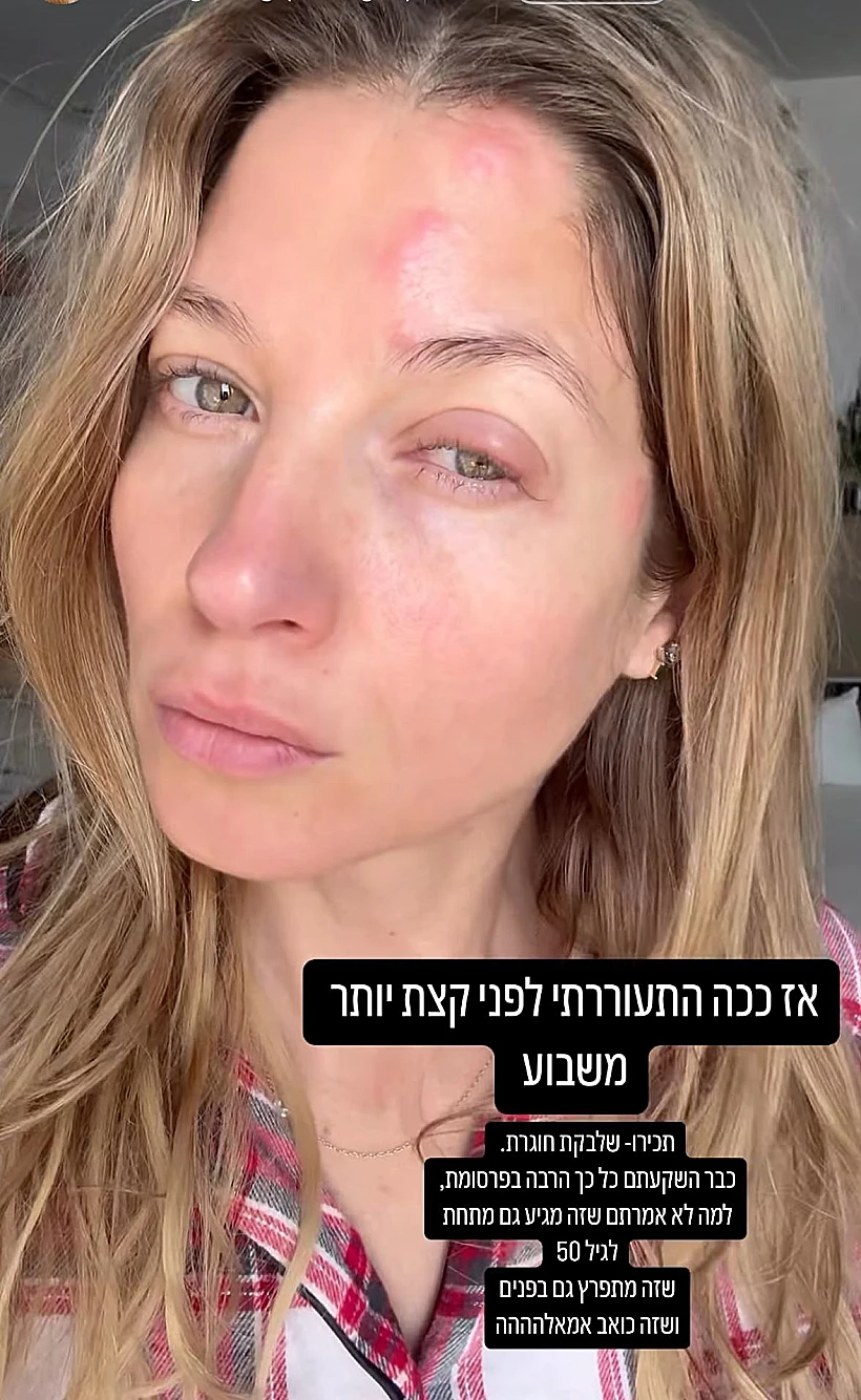 עדי הימלבלוי