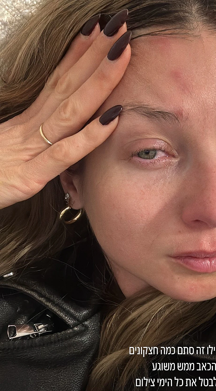 עדי הימלבלוי