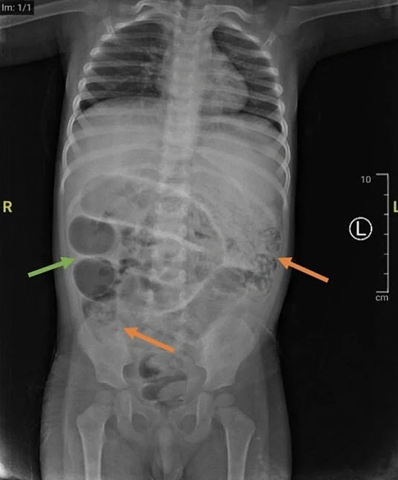 Journal Of Medical Case Report