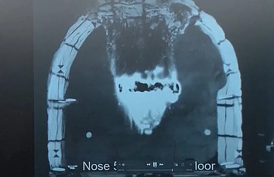 תיעוד מהתקיפה האמריקנית באיראן