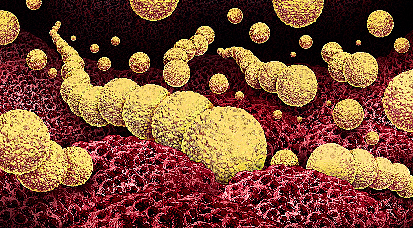 Flesh,eating,bacteria,or,flesh Eating,bactrial,infection,as,a,dangerous