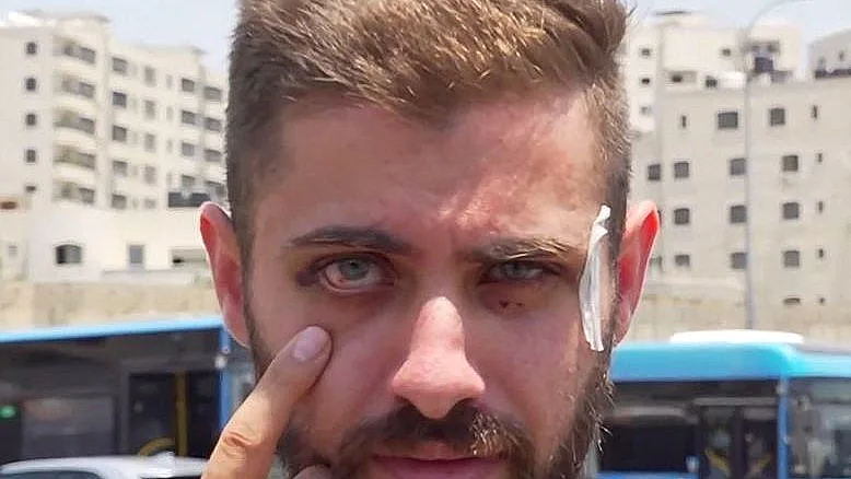 אחמד שחאדה, נהג האוטובוס שהותקף בירושלים