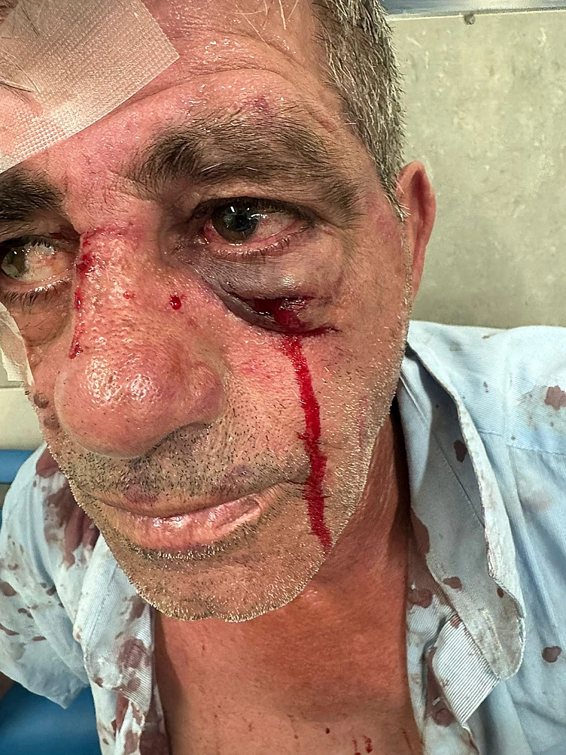 נהג האוטובוס שהותקף בטבריה