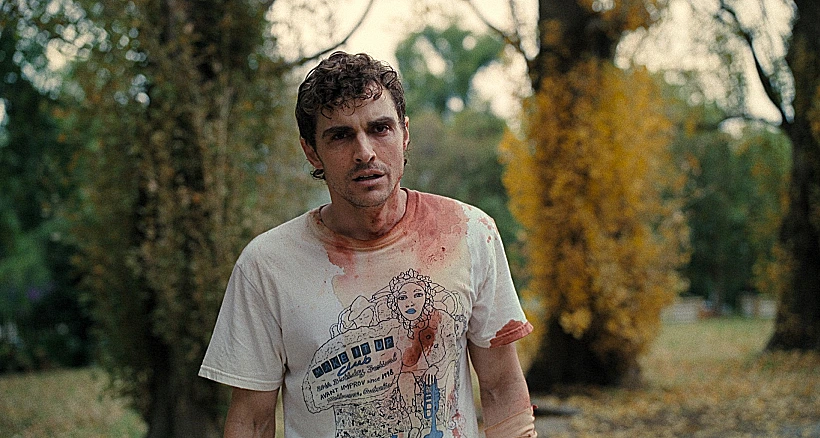 דייב פרנקו ב"צמודים"