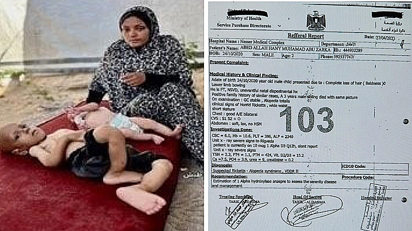הילד האני אבו-זרקה והמסמך שמפרט את ההיסטוריה הרפואית שלו