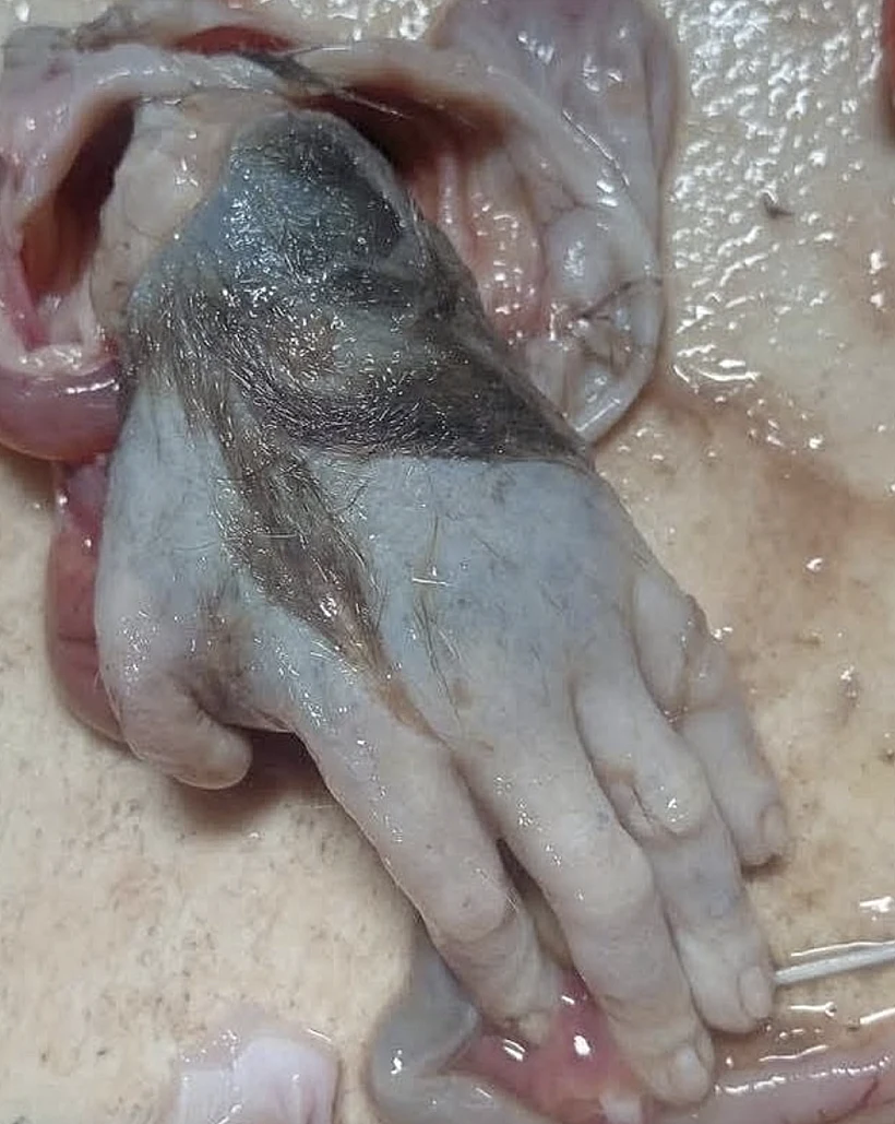 כף יד נמצאה בתוך דג שפמנון