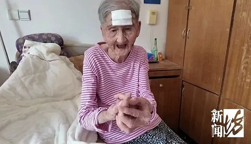 קשישה הסירה בעצמה קרן שצמחה לה על המצח