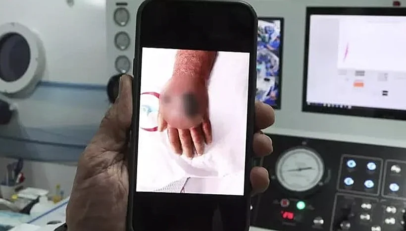 הזרוע הפצועה