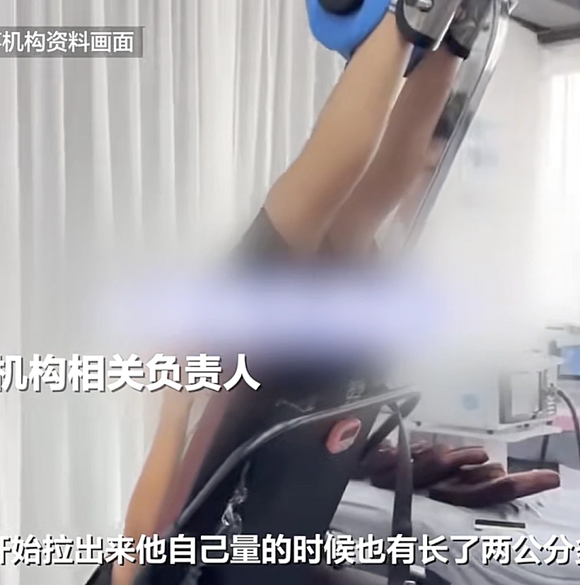 טיפולי הגבהה בסין