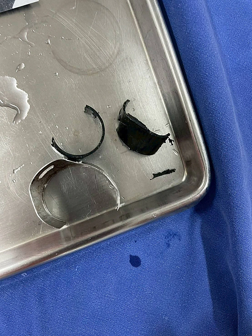 נעל את איבר מינו עם טבעות פלדה ופלסטיק