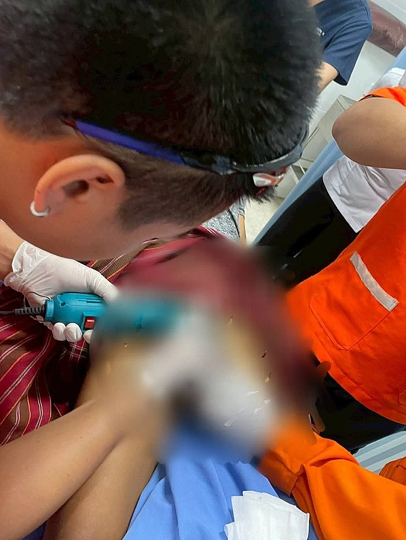 נעל את איבר מינו עם טבעות פלדה ופלסטיק