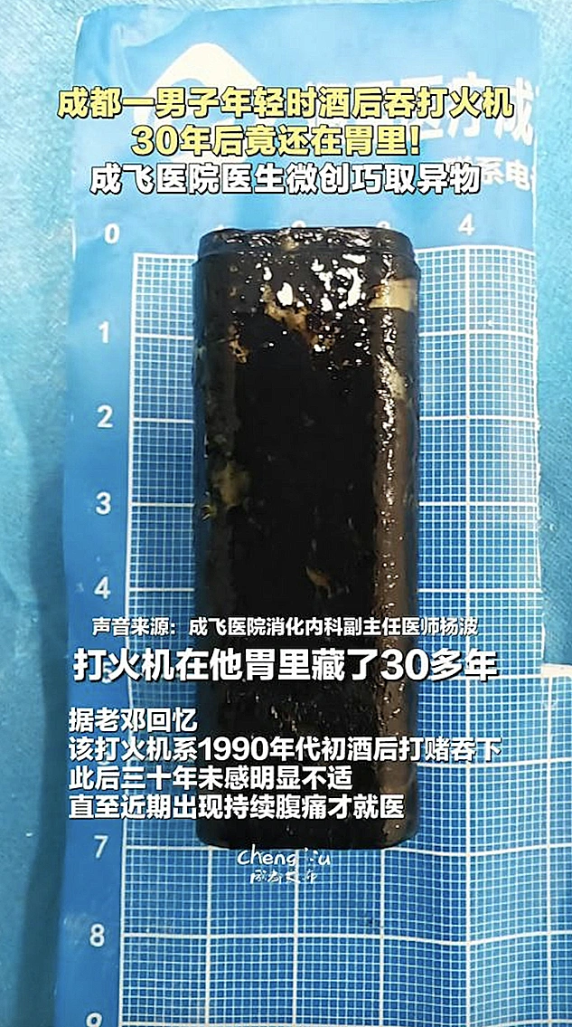 המצית שנבלעה