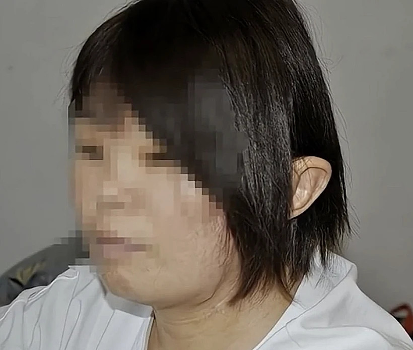 המטופלת שאוזנה נתלשה בתאונה