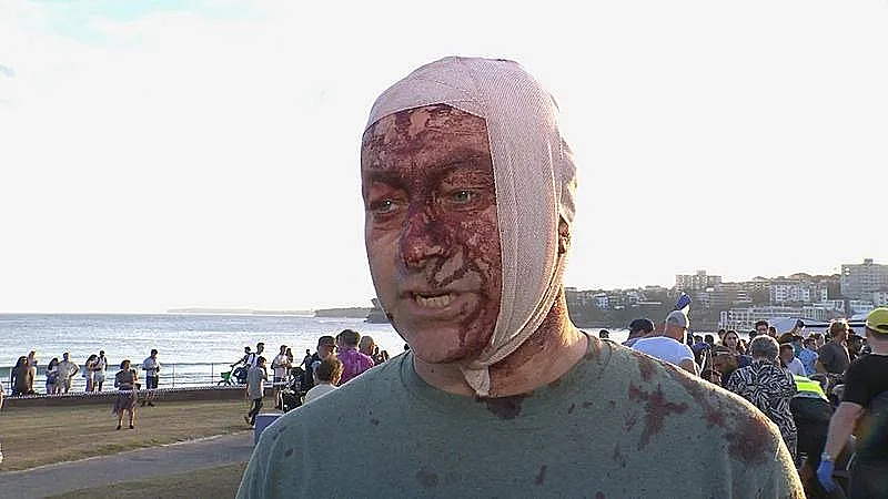 שרד את 7 באוקטובר - ונפצע בפיגוע בסידני