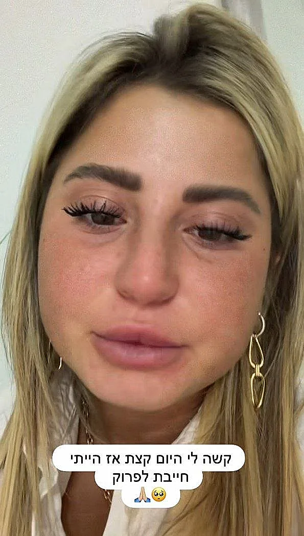 מתוך הסטורי של שלקה