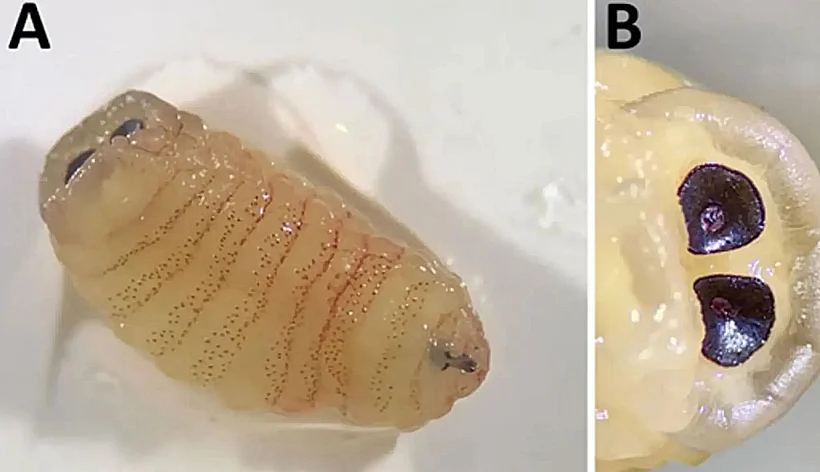 רופאי אף אוזן גרון ביצעו הליך כירורגי והוציאו לא פחות מ-10 זחלים וגולם אחד מהסינוסים שלה