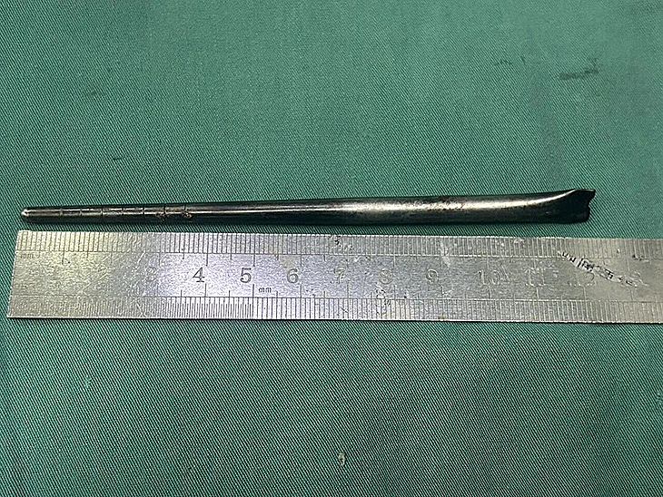 בבית החולים הדגישו שהסוף היחסית טוב לא הופך את המקרה לפחות מסוכן