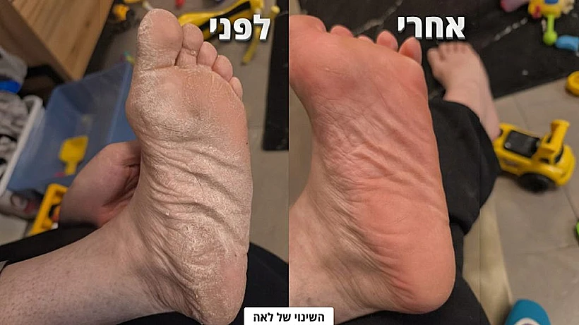 השינוי של לאה