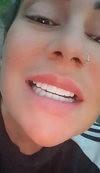 ג'קי לין עם סט השיניים התותבות