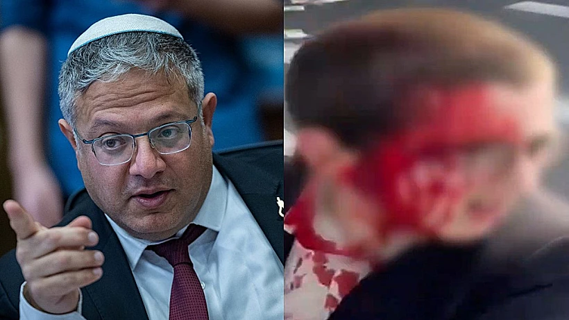 נער שנפצע במהלך העימותים מול משטרה בהפגנות החרדים, השר לבט"ל בן גביר