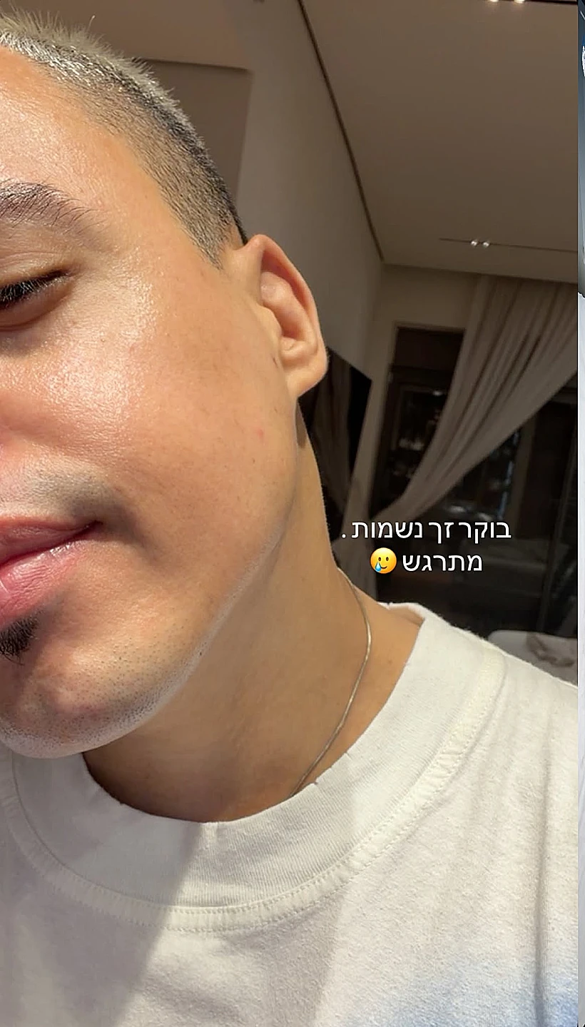 סטטיק