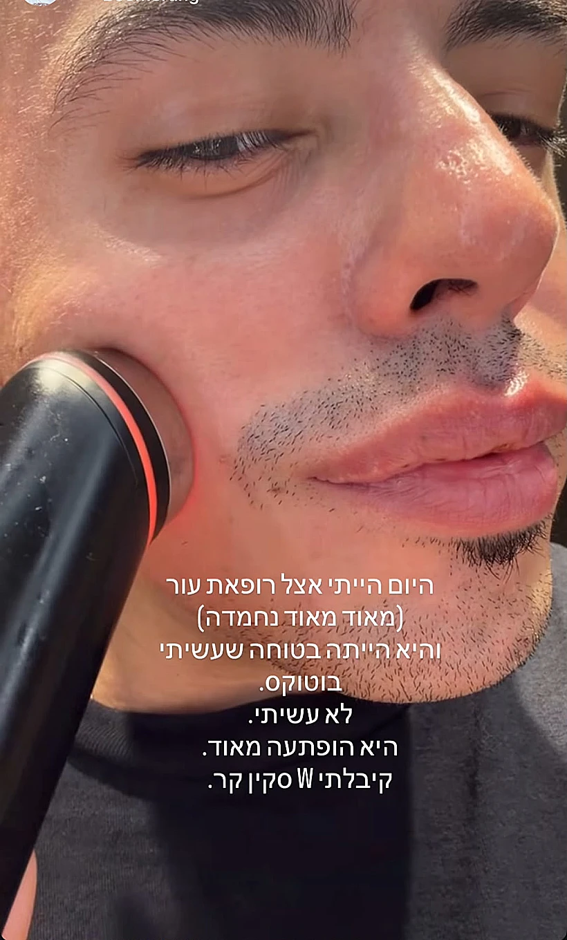 סטטיק