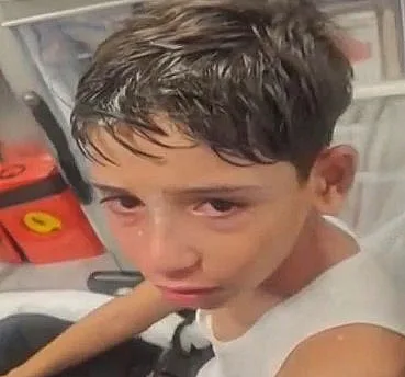 הילד וויליאם, שהותקף בירושלים
