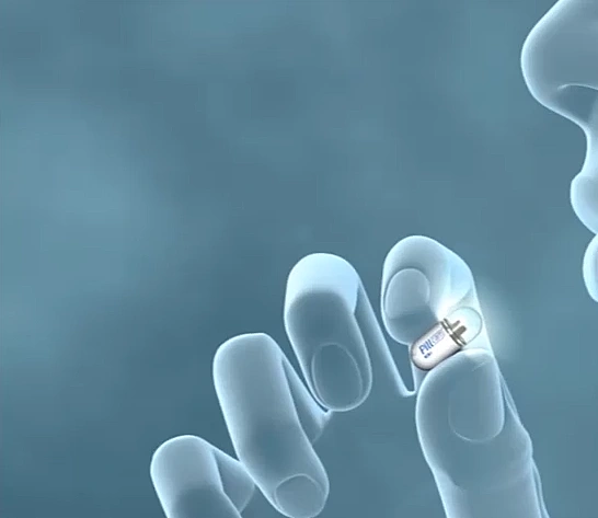 פילקאם, המצלמה הזעירה שנכנסת לתוך הגוף ומקלה על הבדיקות הפולשניות