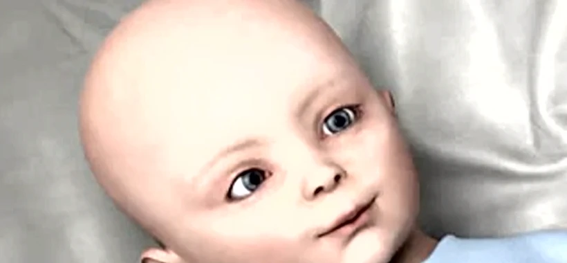 הדמיית עין עצלה