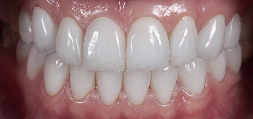 אריאל סביון