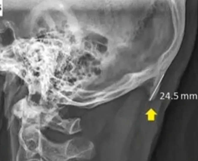 עצם הסמארטפון