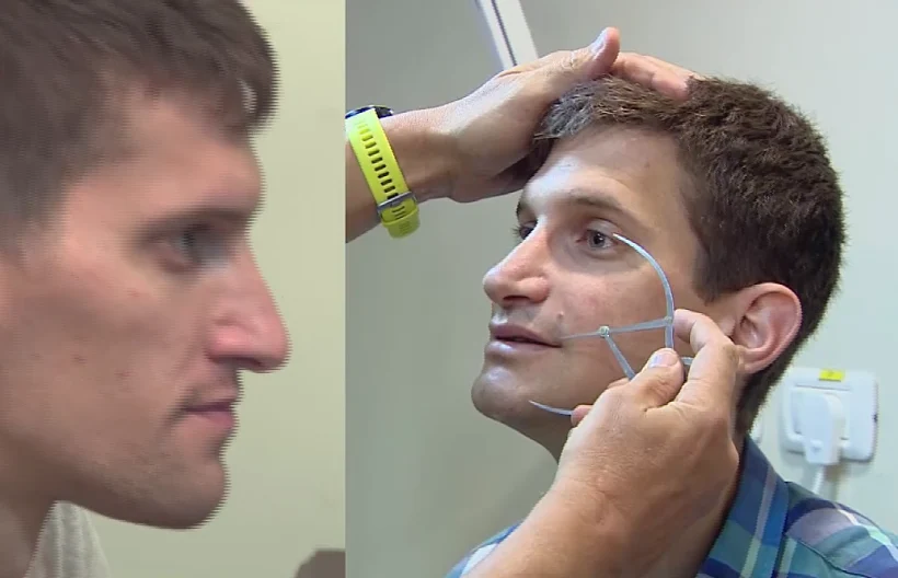 גולן פרגמין, לפני הניתוח ואחרי