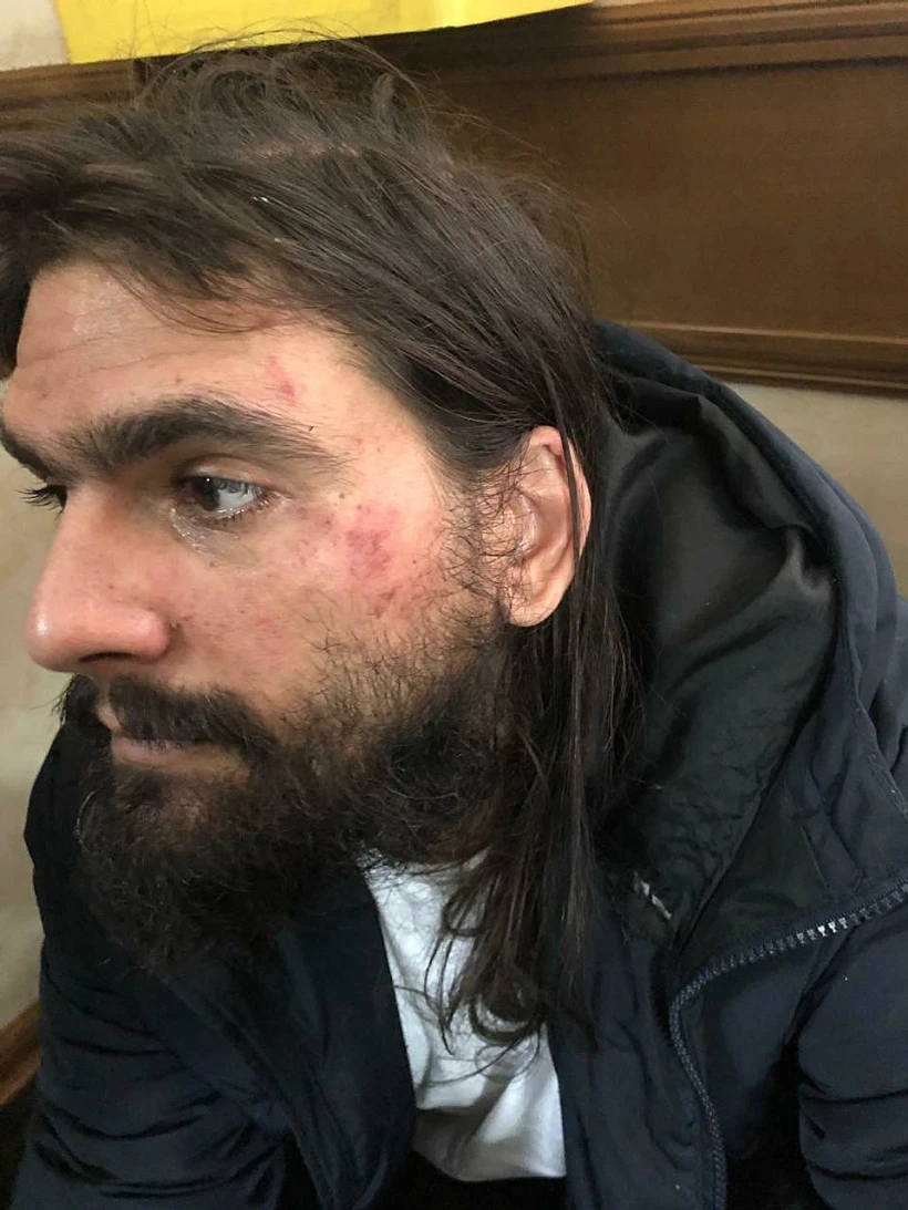 עמוס סילבר, מייסד טלגראס, לאחר מעצרו באוקראינה