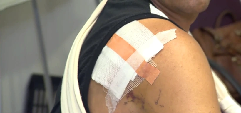 הפציעה שנגמרה לו על ידי השכן