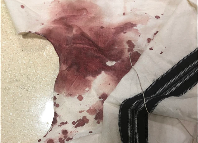 הציצית של אברהם גופין שהותקף בברוקלין