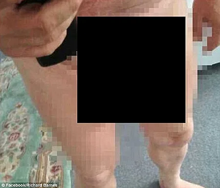 תמונת העירום שהועלתה לפרופיל הפייסבוק של ברנס