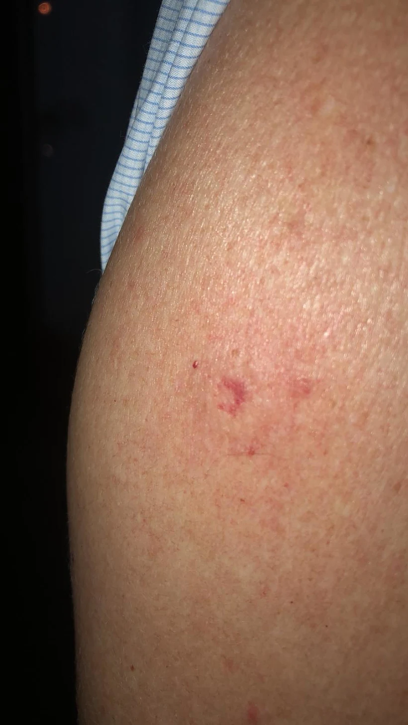 תמונה מהפציעה של הפעיל